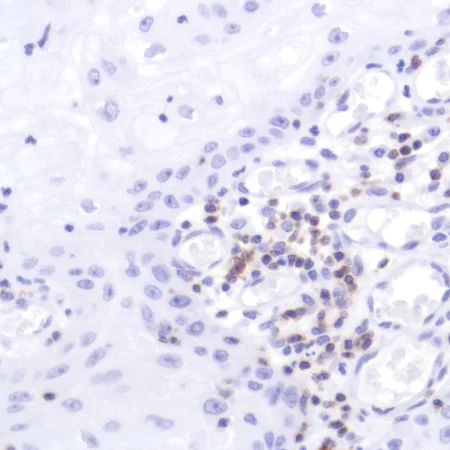 Immunohistochemistry (Formalin/PFA-fixed paraffin-embedded sections) - Anti-CD2 antibody [SP304] - BSA and Azide free (AB272017)