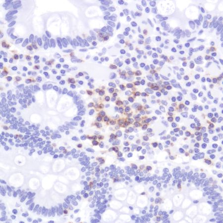 Immunohistochemistry (Formalin/PFA-fixed paraffin-embedded sections) - Anti-CD2 antibody [SP304] - BSA and Azide free (AB272017), expandable thumbnail