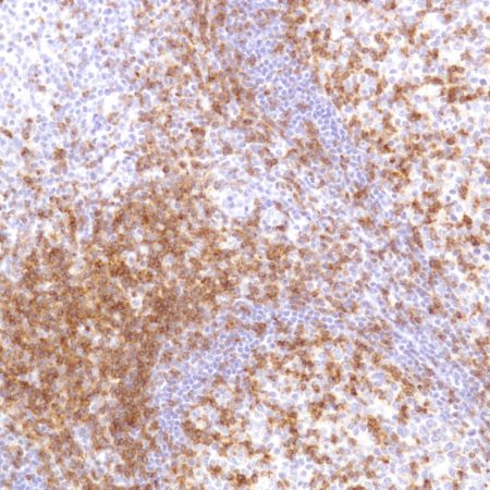 Immunohistochemistry (Formalin/PFA-fixed paraffin-embedded sections) - Anti-CD2 antibody [SP304] - BSA and Azide free (AB272017), expandable thumbnail