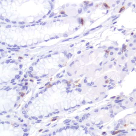 Immunohistochemistry (Formalin/PFA-fixed paraffin-embedded sections) - Anti-CD2 antibody [SP304] - BSA and Azide free (AB272017), expandable thumbnail