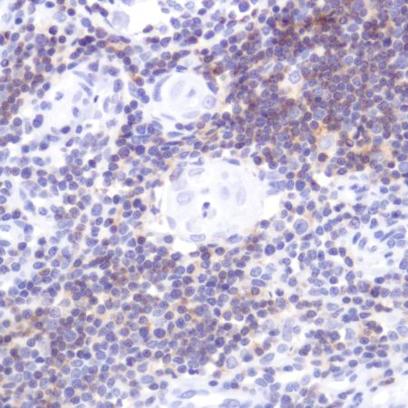 Immunohistochemistry (Formalin/PFA-fixed paraffin-embedded sections) - Anti-CD2 antibody [SP304] - BSA and Azide free (AB272017), expandable thumbnail