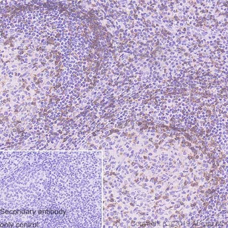 Immunohistochemistry (Formalin/PFA-fixed paraffin-embedded sections) - Anti-CD2 antibody [SP304] - BSA and Azide free (ab272017), expandable thumbnail