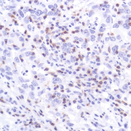 Immunohistochemistry (Formalin/PFA-fixed paraffin-embedded sections) - Anti-CD2 antibody [SP304] - BSA and Azide free (ab272017), expandable thumbnail