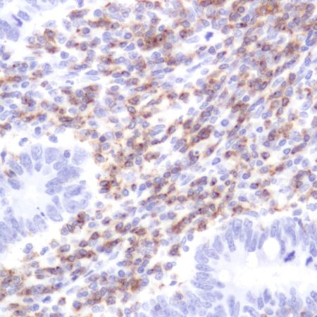 Immunohistochemistry (Formalin/PFA-fixed paraffin-embedded sections) - Anti-CD2 antibody [SP304] - BSA and Azide free (ab272017), expandable thumbnail