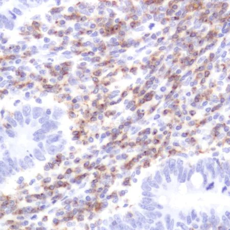 Immunohistochemistry (Formalin/PFA-fixed paraffin-embedded sections) - Anti-CD2 antibody [SP304] - BSA and Azide free (AB272017)