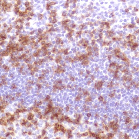 Immunohistochemistry (Formalin/PFA-fixed paraffin-embedded sections) - Anti-CD2 antibody [SP304] - BSA and Azide free (AB272017), expandable thumbnail