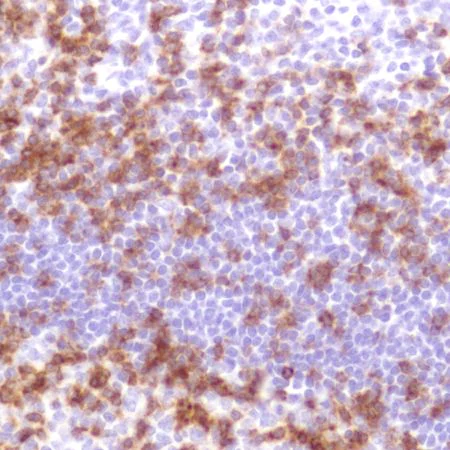 Immunohistochemistry (Formalin/PFA-fixed paraffin-embedded sections) - Anti-CD2 antibody [SP304] - BSA and Azide free (AB272017)