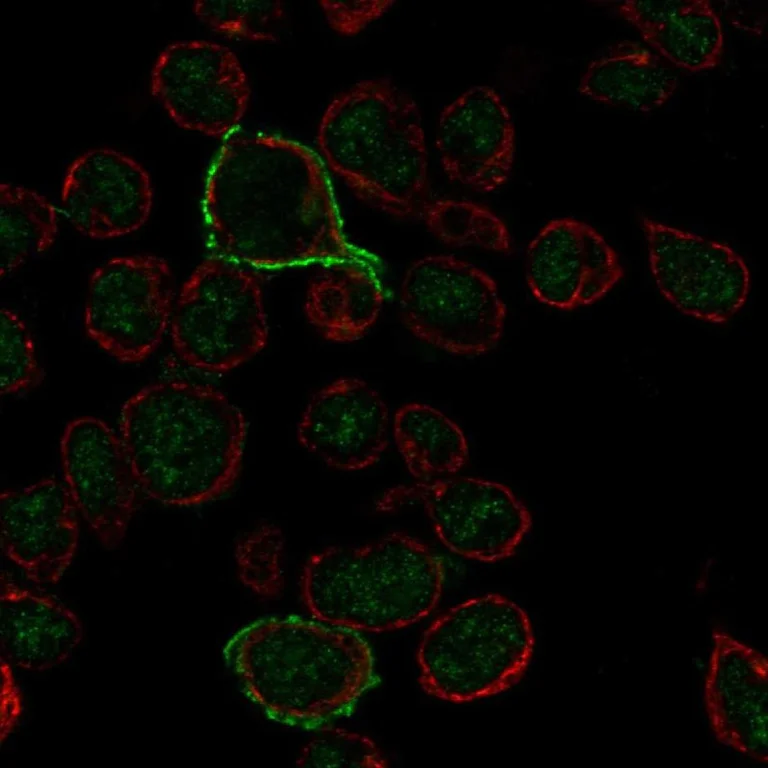 Immunocytochemistry/ Immunofluorescence - Anti-CD20 antibody (AB244336)