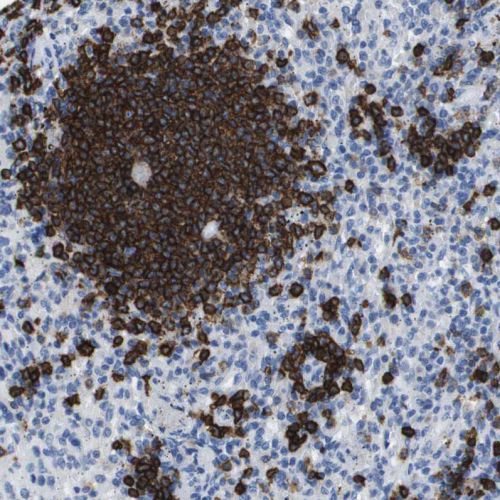 Immunohistochemistry (Formalin/PFA-fixed paraffin-embedded sections) - Anti-CD20 antibody (AB244336)