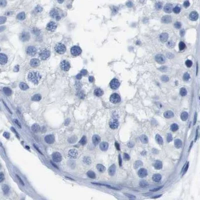Immunohistochemistry (Formalin/PFA-fixed paraffin-embedded sections) - Anti-CD20 antibody (AB244336)