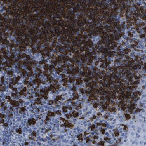 Immunohistochemistry (Formalin/PFA-fixed paraffin-embedded sections) - Anti-CD20 antibody (AB244336)