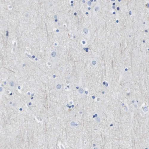 Immunohistochemistry (Formalin/PFA-fixed paraffin-embedded sections) - Anti-CD20 antibody (AB244336)