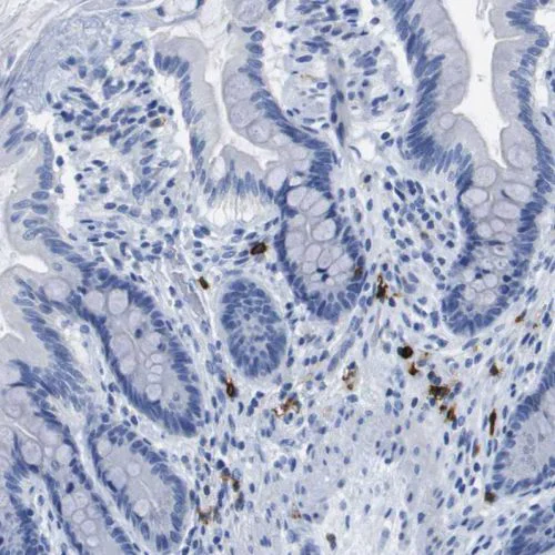 Immunohistochemistry (Formalin/PFA-fixed paraffin-embedded sections) - Anti-CD20 antibody (AB244336)