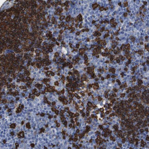 Immunohistochemistry (Formalin/PFA-fixed paraffin-embedded sections) - Anti-CD20 antibody (AB244336)