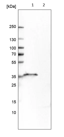 Western blot - Anti-CD20 antibody (AB244336)