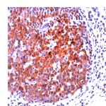 Immunohistochemistry (Formalin/PFA-fixed paraffin-embedded sections) - Anti-CD20 antibody (AB27093)