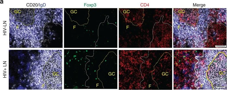 Immunohistochemistry - Anti-CD20 antibody (AB27093)