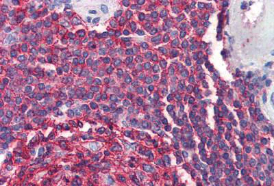 Immunohistochemistry (Formalin/PFA-fixed paraffin-embedded sections) - Anti-CD20 antibody - C-terminal (AB194970)