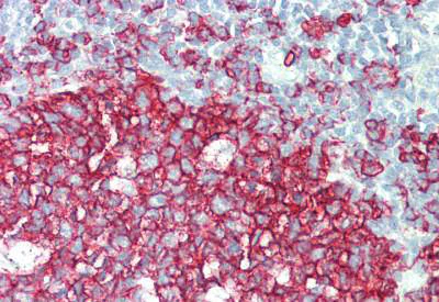 Immunohistochemistry (Formalin/PFA-fixed paraffin-embedded sections) - Anti-CD20 antibody - C-terminal (AB194970)