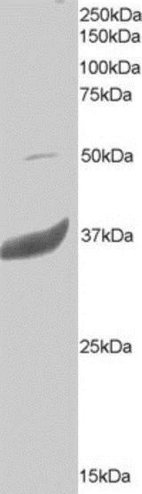 Western blot - Anti-CD20 antibody - C-terminal (AB194970)