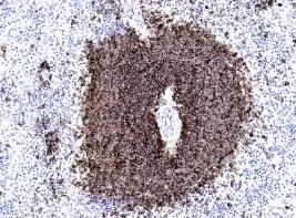 Immunohistochemistry (Formalin/PFA-fixed paraffin-embedded sections) - Anti-CD20 antibody [EP459Y] (AB78237)