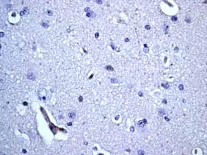 Immunohistochemistry (Formalin/PFA-fixed paraffin-embedded sections) - Anti-CD20 antibody [EP459Y] (AB78237)