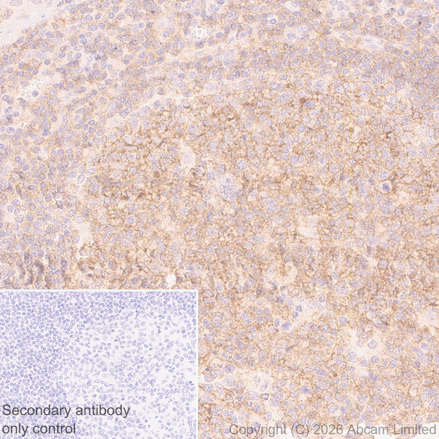Anti-CD20 antibody [EP459Y] (ab78237) | Abcam