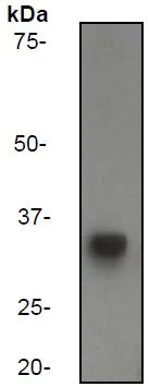 Western blot - Anti-CD20 antibody [EP459Y] (AB78237)