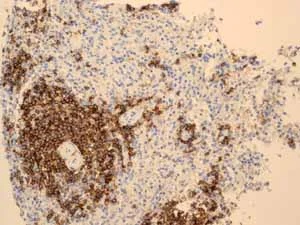 Immunohistochemistry (Formalin/PFA-fixed paraffin-embedded sections) - Anti-CD20 antibody [EP459Y] - BSA and Azide free (AB214282)