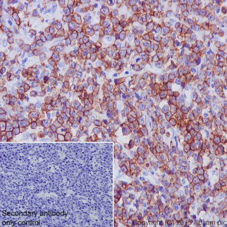 Immunohistochemistry (Formalin/PFA-fixed paraffin-embedded sections) - Anti-CD20 antibody [EP459Y] - Low endotoxin, Azide free (AB166865), expandable thumbnail