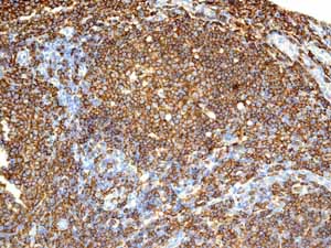 Immunohistochemistry (Formalin/PFA-fixed paraffin-embedded sections) - Anti-CD20 antibody [EP459Y] - Low endotoxin, Azide free (ab166865), expandable thumbnail