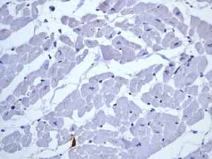 Immunohistochemistry (Formalin/PFA-fixed paraffin-embedded sections) - Anti-CD20 antibody [EP459Y] - Low endotoxin, Azide free (ab166865), expandable thumbnail