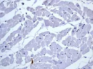 Immunohistochemistry (Formalin/PFA-fixed paraffin-embedded sections) - Anti-CD20 antibody [EP459Y] - Low endotoxin, Azide free (AB166865)