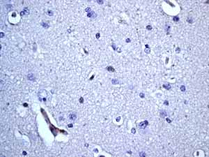 Immunohistochemistry (Formalin/PFA-fixed paraffin-embedded sections) - Anti-CD20 antibody [EP459Y] - Low endotoxin, Azide free (ab166865), expandable thumbnail