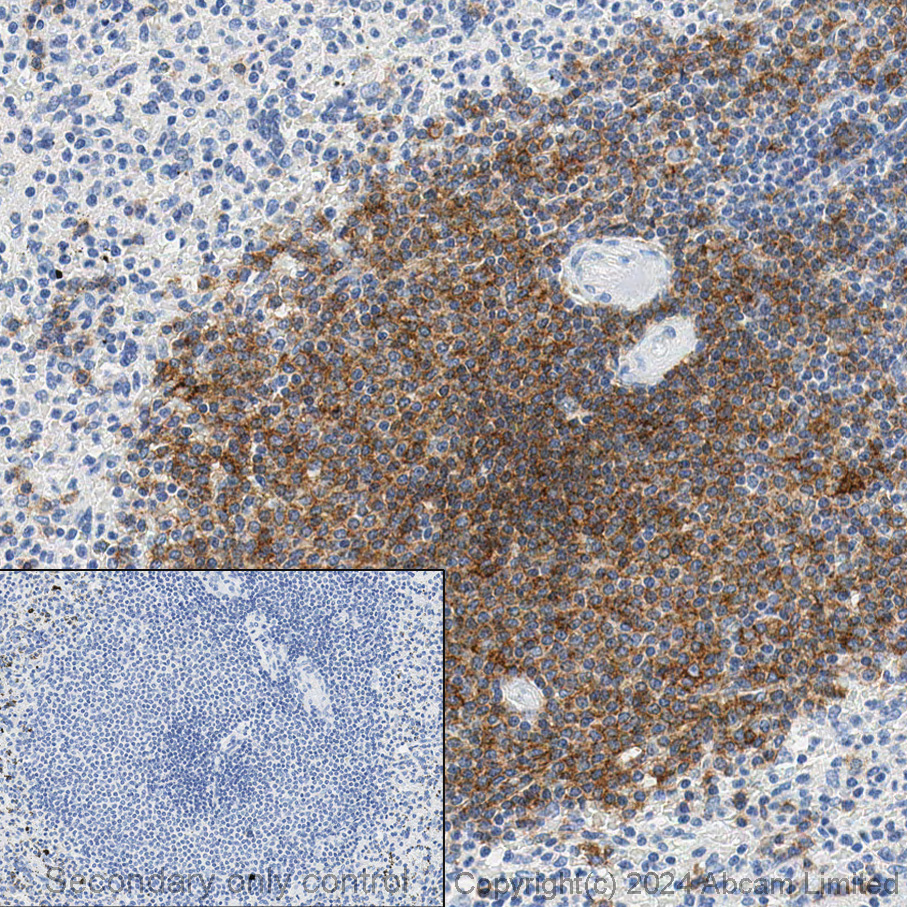 Immunohistochemistry (Formalin/PFA-fixed paraffin-embedded sections) - Anti-CD20 antibody [EP459Y] - Low endotoxin, Azide free (ab166865), expandable thumbnail