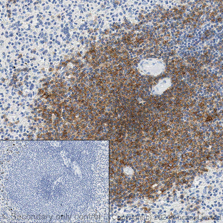 Immunohistochemistry (Formalin/PFA-fixed paraffin-embedded sections) - Anti-CD20 antibody [EP459Y] - Low endotoxin, Azide free (AB166865)