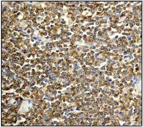 Immunohistochemistry (Formalin/PFA-fixed paraffin-embedded sections) - Anti-CD20 antibody [EP459Y] - Low endotoxin, Azide free (ab166865), expandable thumbnail