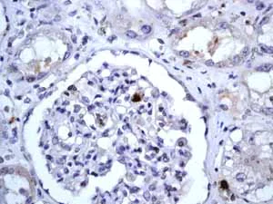 Immunohistochemistry (Formalin/PFA-fixed paraffin-embedded sections) - Anti-CD20 antibody [EP459Y] - Low endotoxin, Azide free (AB166865)