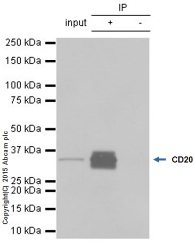Immunoprecipitation - Anti-CD20 antibody [EP459Y] - Low endotoxin, Azide free (AB166865), expandable thumbnail
