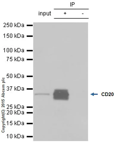 Immunoprecipitation - Anti-CD20 antibody [EP459Y] - Low endotoxin, Azide free (AB166865)