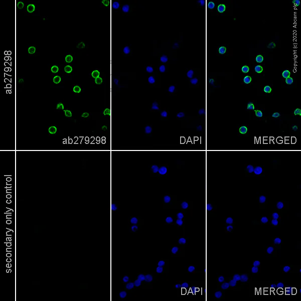 Immunocytochemistry - Anti-CD20 antibody [EP459Y] - Mouse IgG1 (Chimeric) (AB279298)