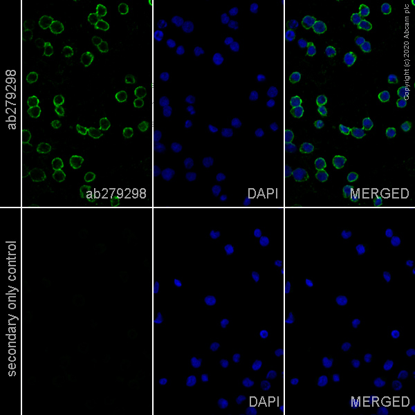 Immunocytochemistry - Anti-CD20 antibody [EP459Y] - Mouse IgG1 (Chimeric) (AB279298), expandable thumbnail