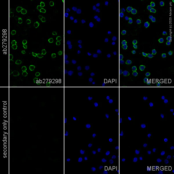 Immunocytochemistry - Anti-CD20 antibody [EP459Y] - Mouse IgG1 (Chimeric) (AB279298)