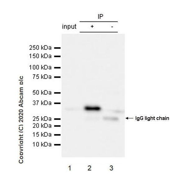 Immunoprecipitation - Anti-CD20 antibody [EP459Y] - Mouse IgG1 (Chimeric) (AB279298), expandable thumbnail