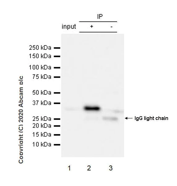 Immunoprecipitation - Anti-CD20 antibody [EP459Y] - Mouse IgG1 (Chimeric) (AB279298)