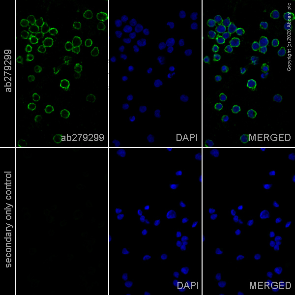 Immunocytochemistry - Anti-CD20 antibody [EP459Y] - Mouse IgG2a (Chimeric) (AB279299), expandable thumbnail