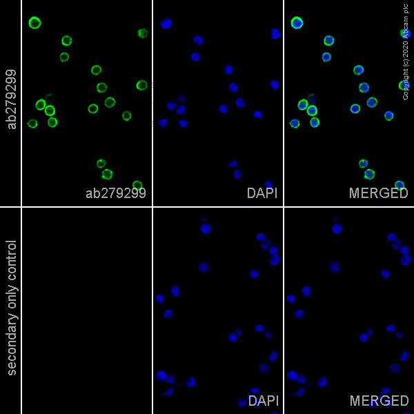 Immunocytochemistry - Anti-CD20 antibody [EP459Y] - Mouse IgG2a (Chimeric) (AB279299), expandable thumbnail