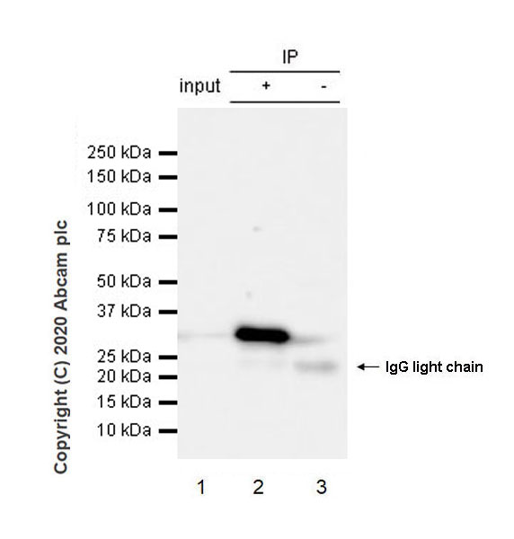Immunoprecipitation - Anti-CD20 antibody [EP459Y] - Mouse IgG2a (Chimeric) (AB279299), expandable thumbnail