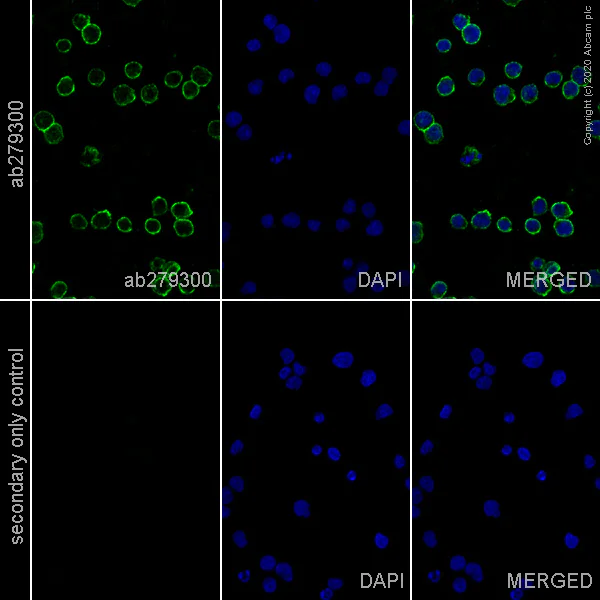 Immunocytochemistry - Anti-CD20 antibody [EP459Y] - Rat IgG2a (Chimeric) (AB279300)