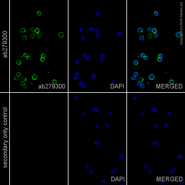 Immunocytochemistry - Anti-CD20 antibody [EP459Y] - Rat IgG2a (Chimeric) (AB279300), expandable thumbnail